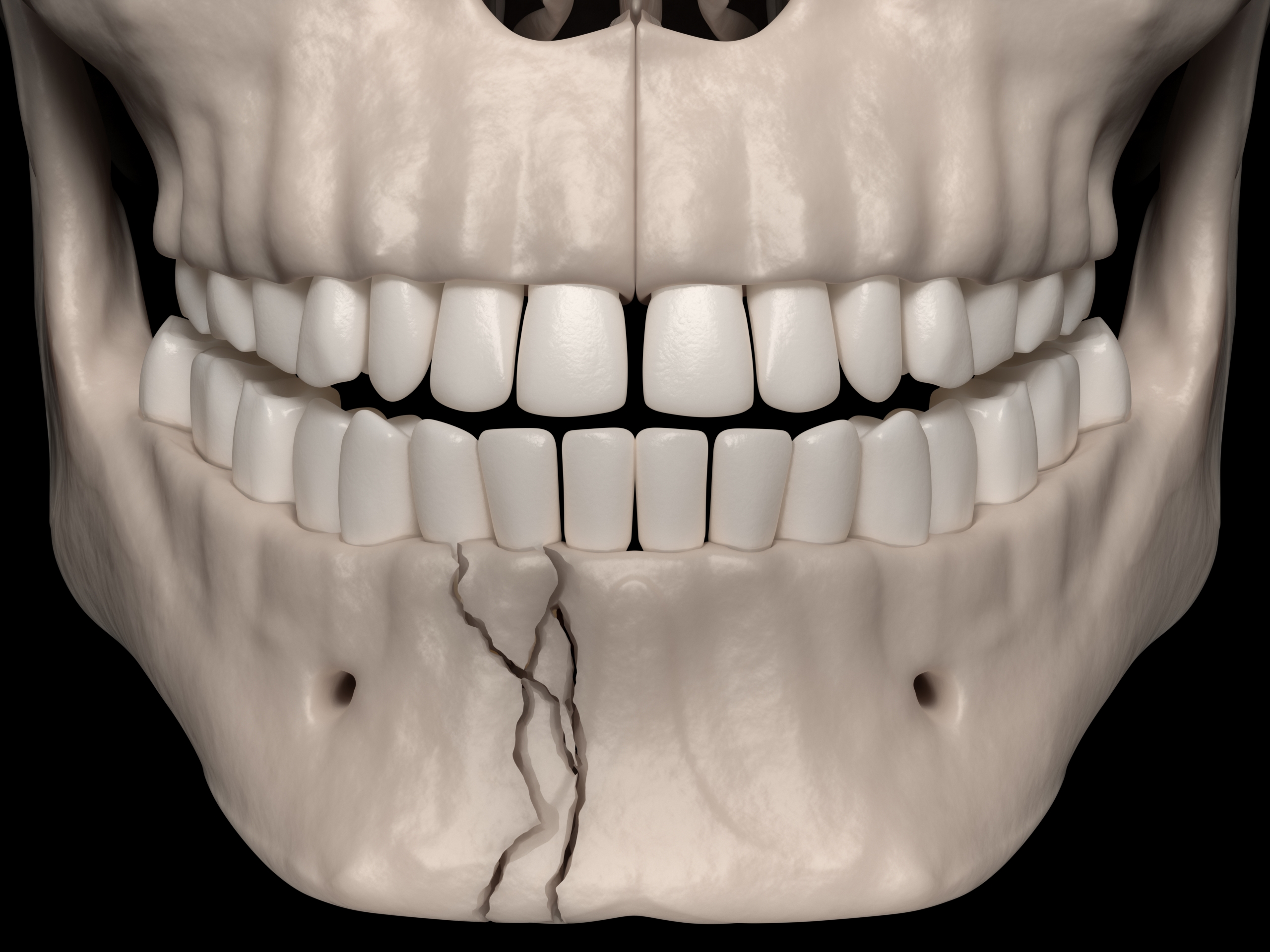 facial-trauma-montville-oral-surgery